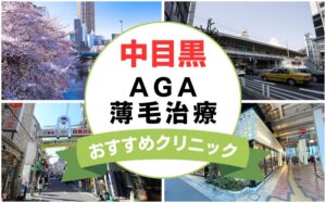 【2025年最新】中目黒でAGA・薄毛治療におすすめなクリニック16選まとめ！