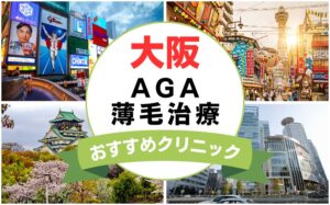 【2025年最新】大阪でAGA・薄毛治療におすすめなクリニック21選まとめ！