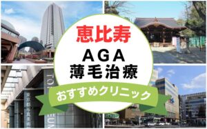 【2025年最新】恵比寿でAGA・薄毛治療におすすめなクリニック16選まとめ！