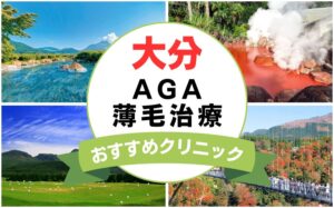 【2025年最新】大分でAGA・薄毛治療におすすめなクリニック13選まとめ！