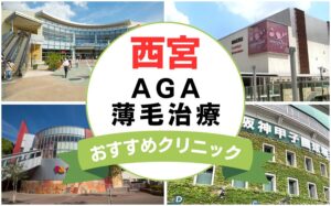 【2025年最新】西宮でAGA・薄毛治療におすすめなクリニック14選まとめ！