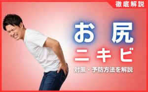 お尻のニキビ対策・予防方法を解説！原因・おすすめ商品を紹介