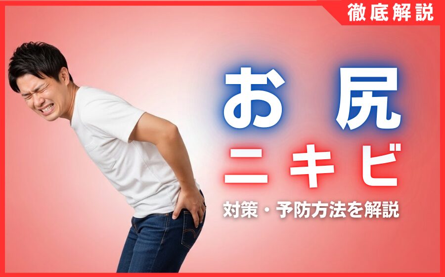 お尻のニキビ対策・予防方法を解説！原因・おすすめ商品を紹介