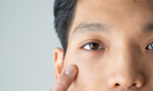 目の下にクマがある男性